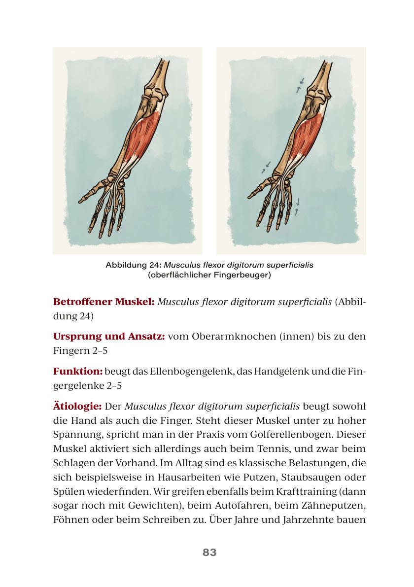 Interior page from A Life Without Pain: forearm flexor muscles